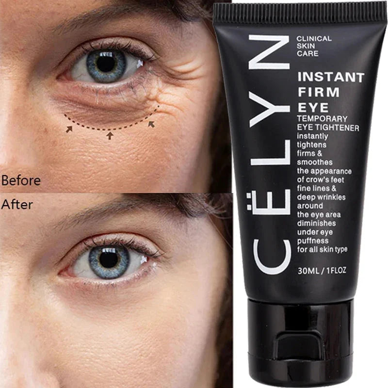 Celyn™ Eye Tightening Cream